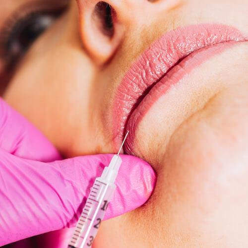 Dermal Fillers